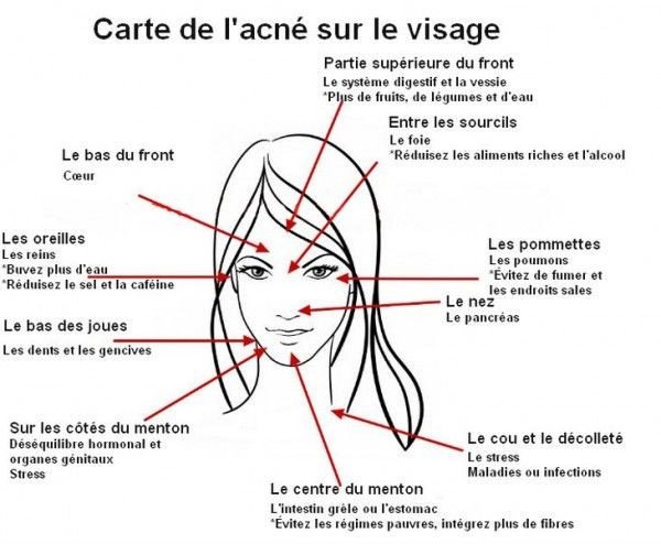 5 MASQUES CONTRE L'ACNÉ #Soinvisage #Skincare #skin #Routinevisage #Acné #Peau