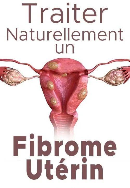 Fibrome : Comment Traiter Naturellement